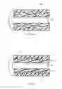 Fig. 07 - Ureteral stents with waveform interlayers and interstitching