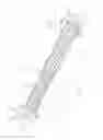 Fig. 02 - Endoluminal device