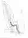 Fig. 03 - Endoluminal device