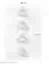 Fig. 16 - Walk-assistive robot and method of controlling the same