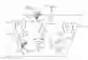 Fig. 01 - METHOD AND APPARATUS FOR CONTROLLING MOVEMENT OF MEDICAL DEVICE