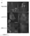 Fig. 02 - TUMOR-INITIATING CELLS AND METHODS OF USE
