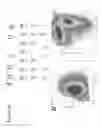 Fig. 21 - TUMOR-INITIATING CELLS AND METHODS OF USE