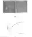 Fig. 02 - Cell line of renal sarcomatoid carcinoma in persons of Han nationality and preparation method thereof