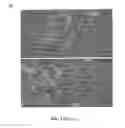Fig. 06 - Methods of modulating thrombocytopenia and modified transgenic pigs