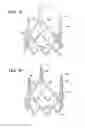 Fig. 23 - Methods of making a durable multi-layer high strength polymer composite suitable for prosthetic valves