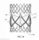 Fig. 35 - Methods of making a durable multi-layer high strength polymer composite suitable for prosthetic valves