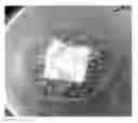 Fig. 01 - CHITOSAN WOUND DRESSING AND ITS METHOD OF MANUFACTURING