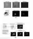 Fig. 04 - Selective embryonic structure targeting and substance delivery device