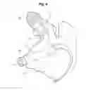 Fig. 05 - Exhaust brake