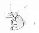 Fig. 08 - HEADGEAR ASSEMBLY WITH IMPROVED STABIIZATION