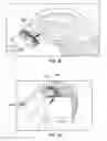 Fig. 11 - Hair dye applicator and methods of use