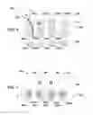 Fig. 03 - Color Filter Array and Micro-Lens Structure for Imaging System