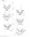 Fig. 02 - Multilayer contact lens and production process therefor