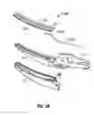 Fig. 04 - Method of manufacturing a jaw member of an electrosurgical end effector assembly