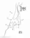 Fig. 07 - Decoupled load-path to reduce the pelvis combined load of a vehicle occupant