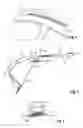 Fig. 05 - Body structure having a roof rail