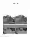 Fig. 23 - Image display system and method of fitting multiple models to image