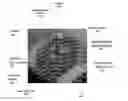 Fig. 01 - Systems and methods for the inspection of contact lenses