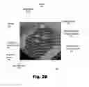 Fig. 05 - Systems and methods for the inspection of contact lenses