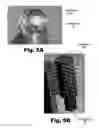 Fig. 11 - Systems and methods for the inspection of contact lenses