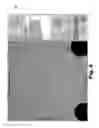 Fig. 15 - Systems and methods for the inspection of contact lenses