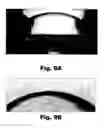 Fig. 16 - Systems and methods for the inspection of contact lenses
