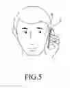 Fig. 06 - Audio resonance device