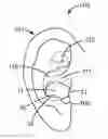 Fig. 01 - Concha-fit electronic hearing protection device