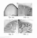 Fig. 03 - Isolated populations of renal stem cells and methods of isolating and using same