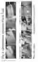 Fig. 04 - METHODS OF DEPOSITING PARTICLES OF A SUBSTANCE IN A TISSUE