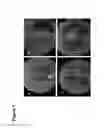 Fig. 02 - Microalgae-derived compositions for improving the health and appearance of skin