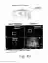 Fig. 08 - Compositions and methods for promoting wound healing and tissue regeneration