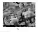 Fig. 02 - Nanoscale collagen particles and membranes