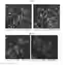 Fig. 44 - Nanoclusters compositions and methods