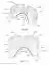 Fig. 64 - Intra-oral light-therapy apparatuses and methods for their use