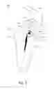 Fig. 05 - Apparatus and methods for cleaning teeth and gingival pockets