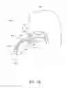 Fig. 10 - Apparatus and methods for cleaning teeth and gingival pockets