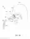 Fig. 11 - Apparatus and methods for cleaning teeth and gingival pockets