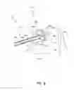 Fig. 12 - Apparatus and methods for cleaning teeth and gingival pockets