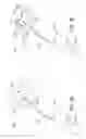 Fig. 15 - Apparatus and methods for cleaning teeth and gingival pockets