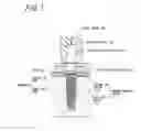 Fig. 02 - DENTAL IMPLANT