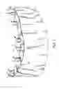 Fig. 02 - COMPONENTS FOR PERMANENT REMOVABLE AND ADJUSTABLE DENTURES AND BRIDGES