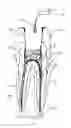 Fig. 06 - Composition and method for using medicament for endodontic irrigation, stem cell preparation and tissue regeneration