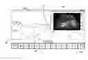 Fig. 01 - System and method for extended spectrum ultrasound training using animate and inanimate training objects