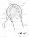 Fig. 15 - Medical device and procedure simulation and training