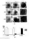 Fig. 02 - ELISpot diagnostic kit for neuromyelitis optica and its application