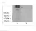 Fig. 05 - Method for producing horseradish peroxidase recombinant protein using filamentous fungus