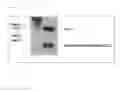 Fig. 07 - Method for producing horseradish peroxidase recombinant protein using filamentous fungus