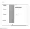 Fig. 09 - Method for producing horseradish peroxidase recombinant protein using filamentous fungus